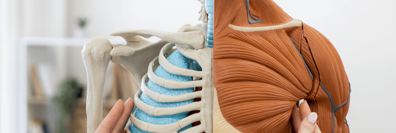 Healthcare professional holding anatomical shoulder model showing both skeletal structure with acromion and clavicle bones and muscular anatomy with rotator cuff tendons and muscles. Educational medical image demonstrating shoulder impingement syndrome anatomy where subacromial space compression causes rotator cuff pain and inflammation. Model illustrates the narrow space between bones where tendons can become pinched during overhead movements or improper sleep positioning after shoulder surgery.